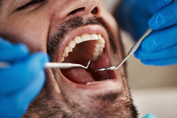 Best Emergency Gum Treatment in Brownstown, IN
