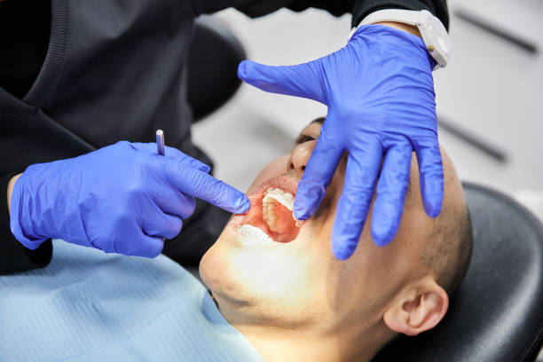 Best Emergency Root Canal Treatment in Brownstown, IN
